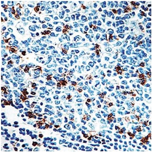 CD57 Antibody IHC