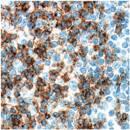 CD2 Antibody IHC