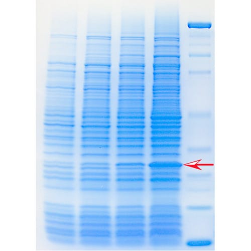 Recombinant Protein Purification
